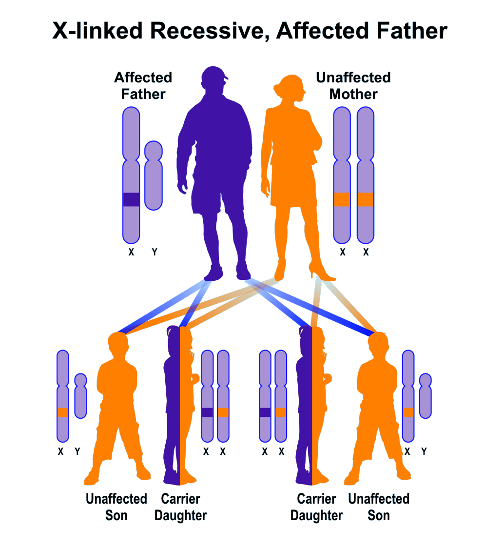 X Linked Recessive Father Affected Hereditary Ocular Diseases 3090