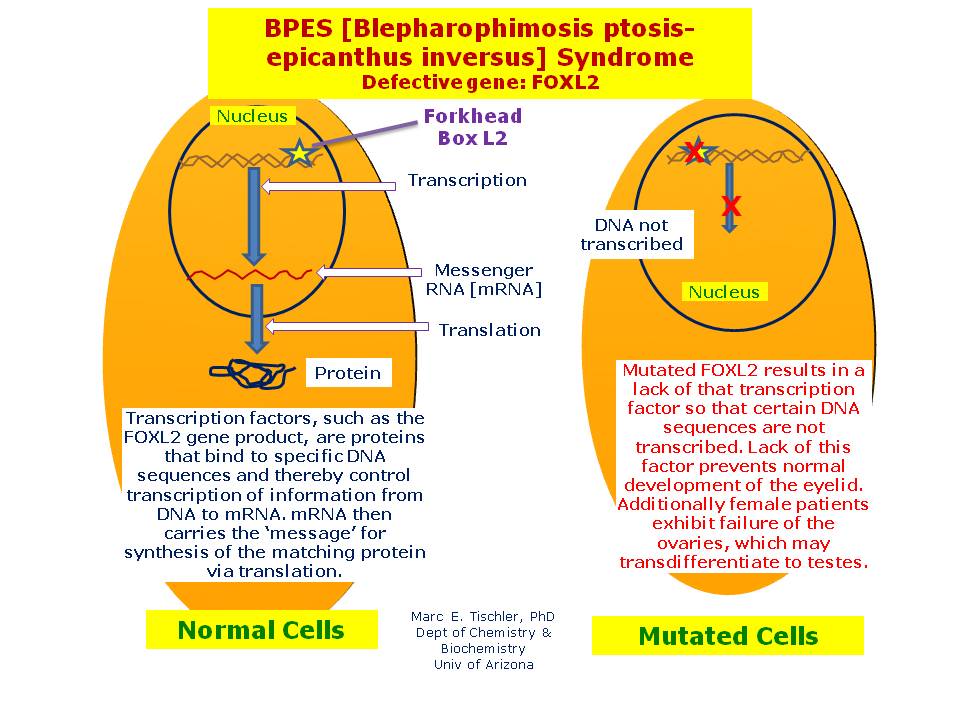 BPES Syndrome | Hereditary Ocular Diseases