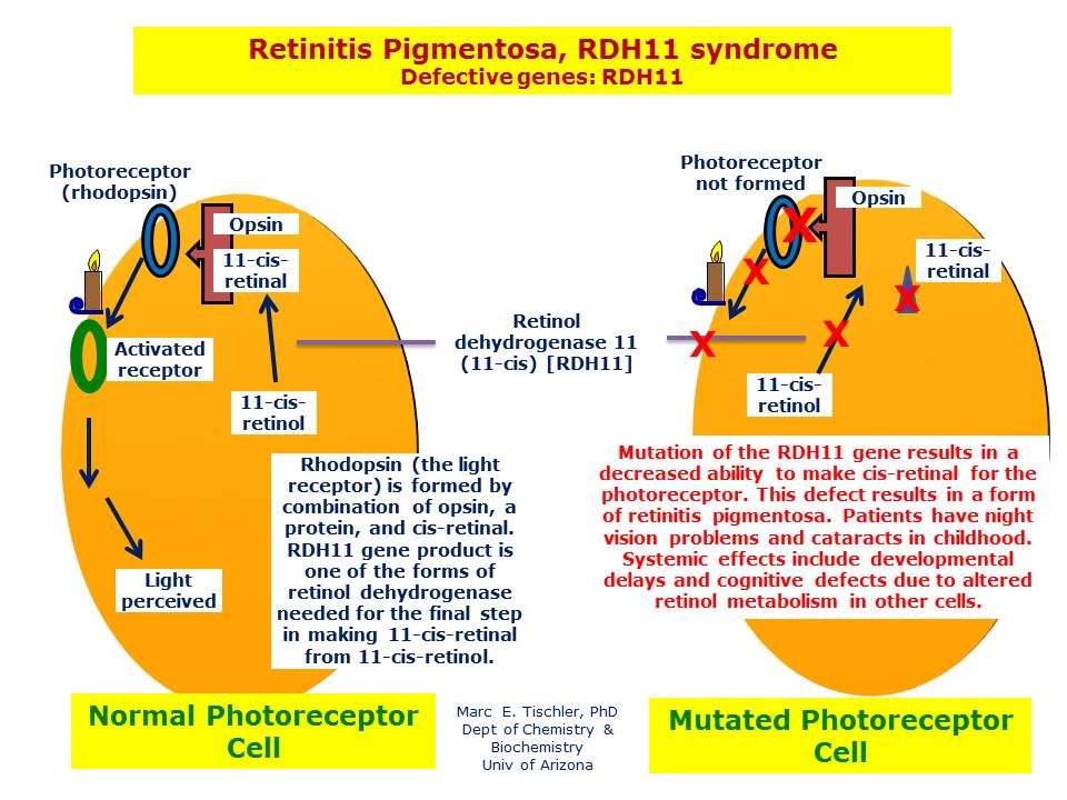 Retinitis Pigmentosa, RDH11 Syndrome Hereditary Ocular Diseases