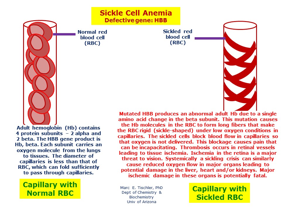 literature review on sickle cell anaemia