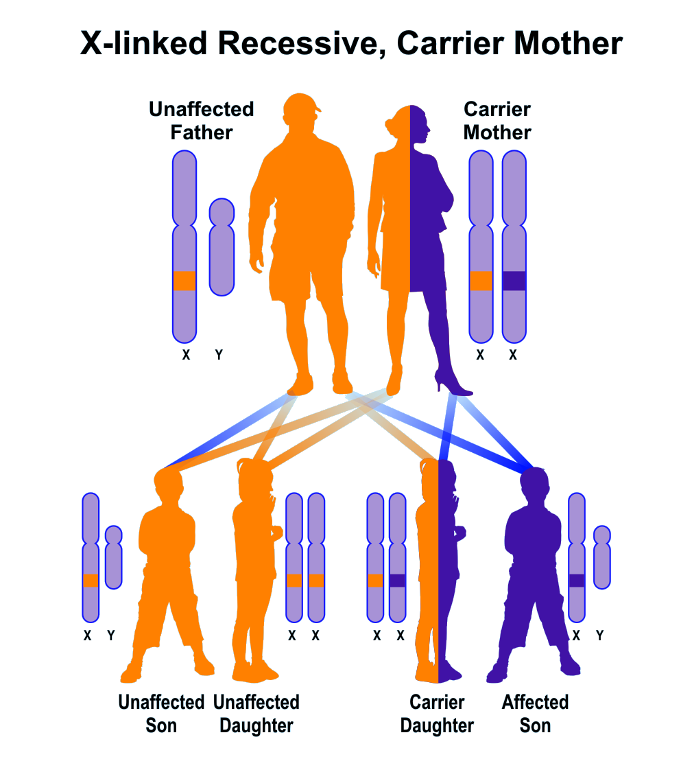 Nystagmus 1 Congenital X Linked Hereditary Ocular Diseases 