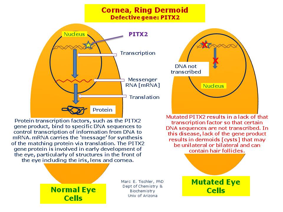 Refractive surgery for keratoconus - Ormonde - 2013 - Clinical and  Experimental Optometry - Wiley Online Library