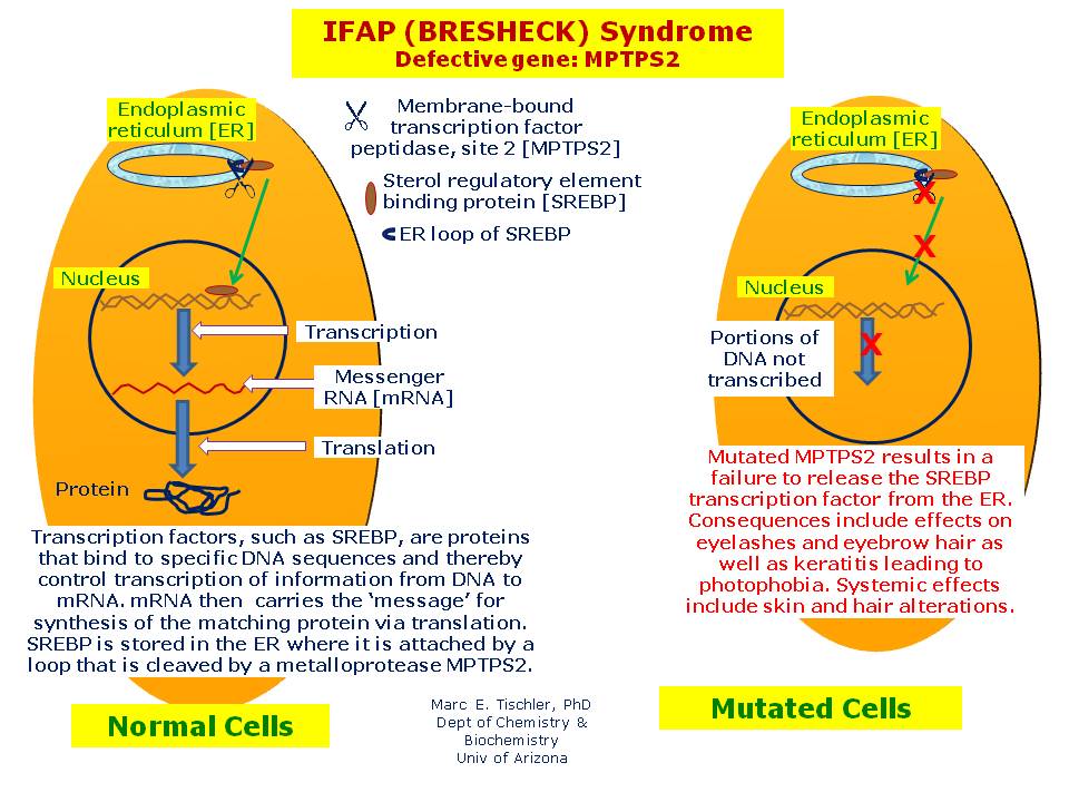 IFAP (BRESHECK) Syndrome | Hereditary Ocular Diseases