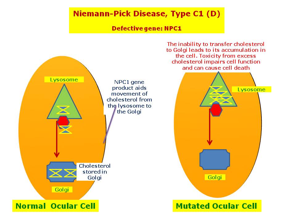 Niemann-Pick disease type C. The diagram represents subtypes and