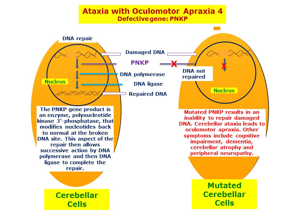 Ocular Motor Apraxia Therapy | Motor Informations
