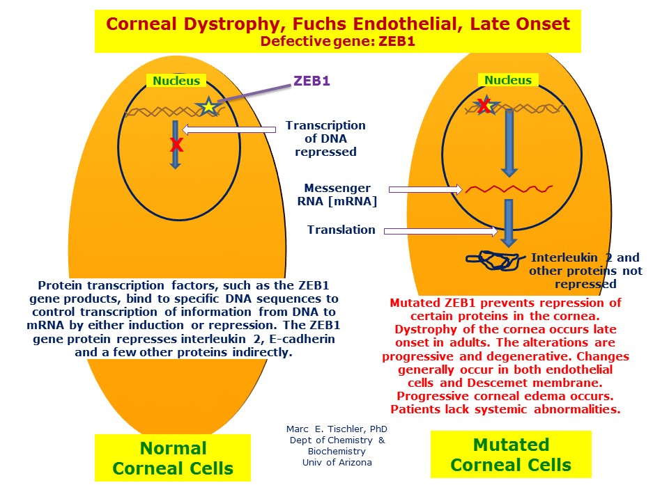Late onset Fuchs endothelial dystrophy is the result of mutations in the ZEB1 gene that interfere with transcription of proteins in corneal cells