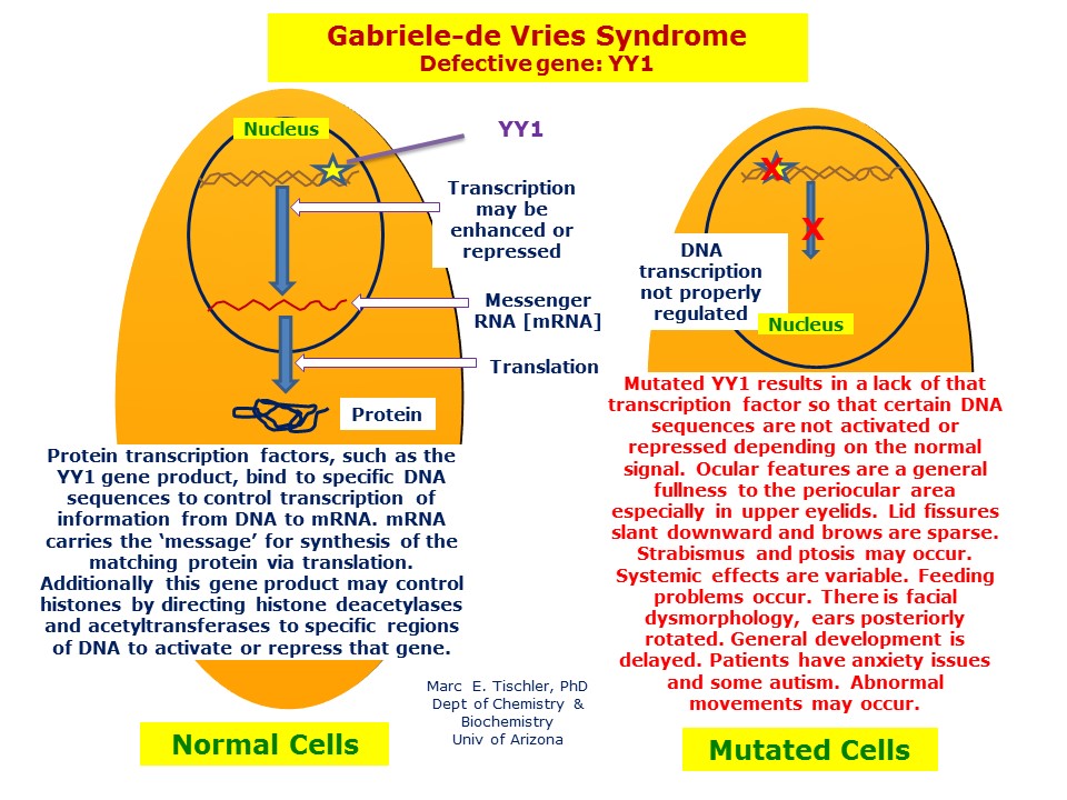 Ongekend Gabriele-de Vries Syndrome | Hereditary Ocular Diseases KS-77