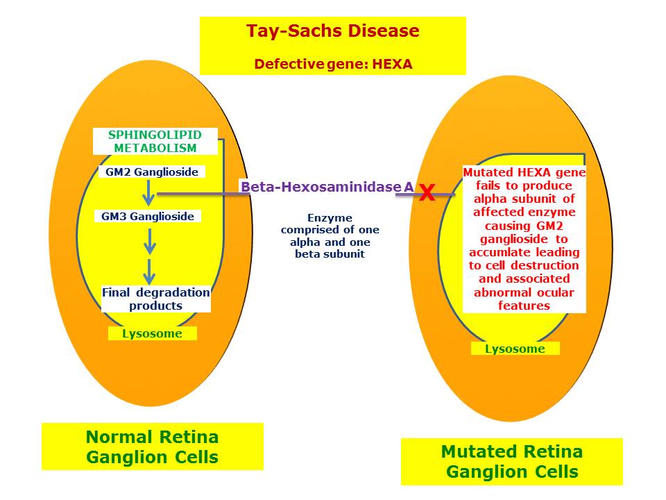 Ganglioside Tay Sachs