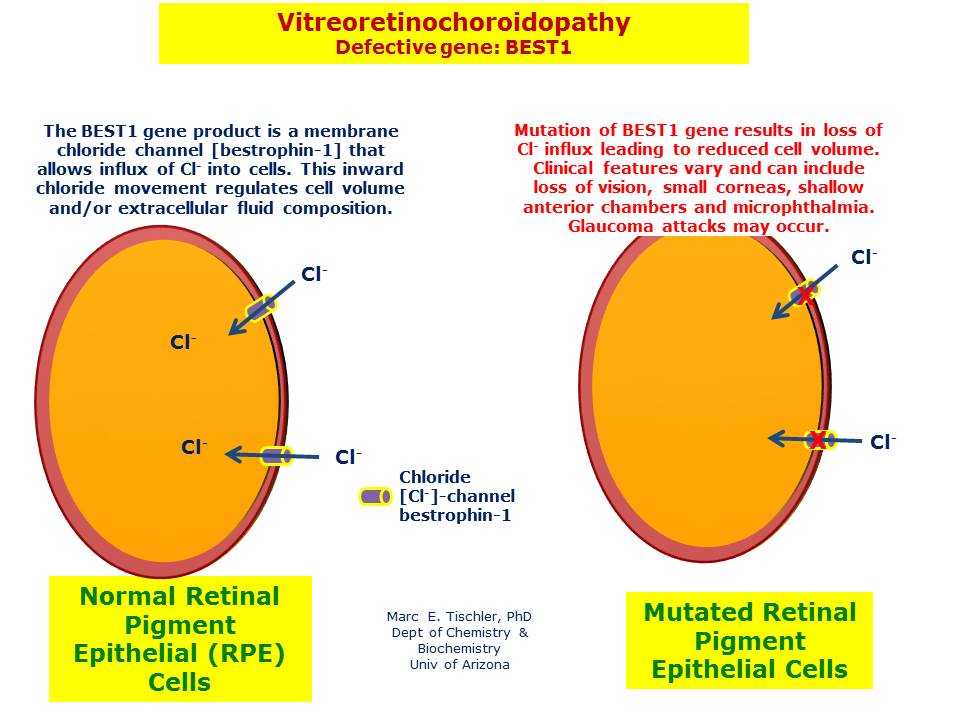 Vitreoretinochoroidopathy Hereditary Ocular Diseases 