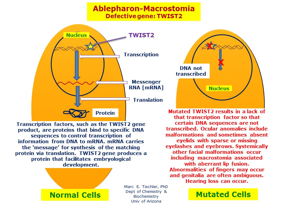 Ablepharon-Macrostomia Syndrome | Hereditary Ocular Diseases